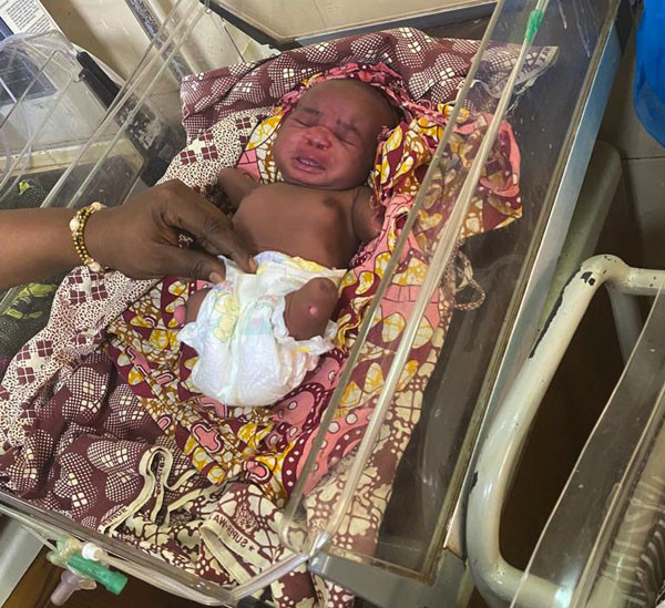 Farabougou : un bébé sans bras ni jambes